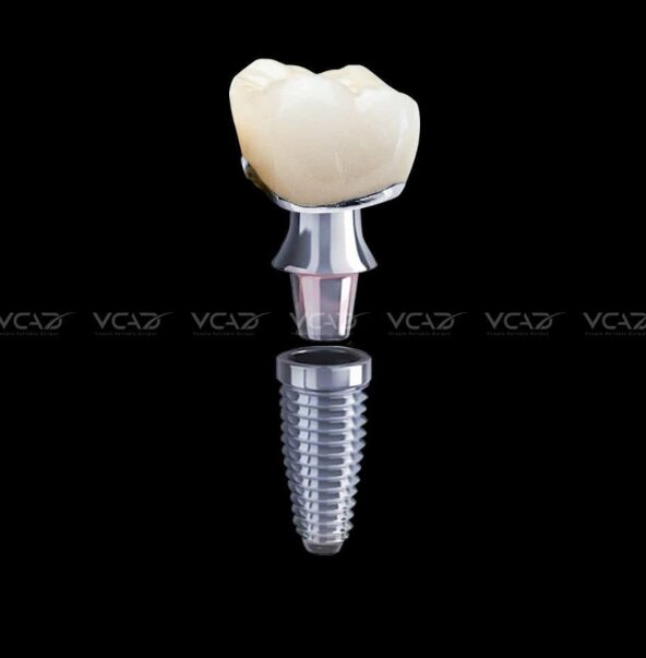 Digital implant crown