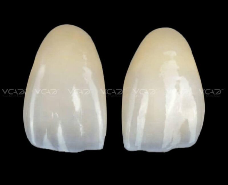 VCAD digital occlusal splint