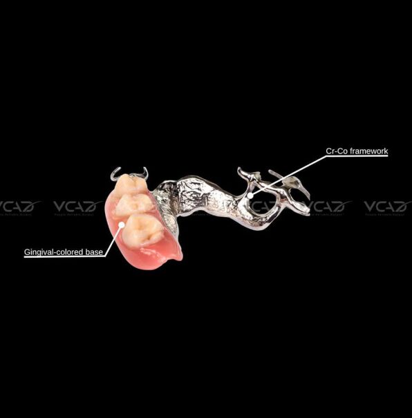 Digital removable partial denture framework