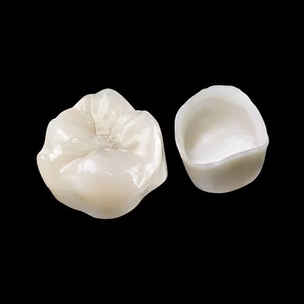 Digital dental crown